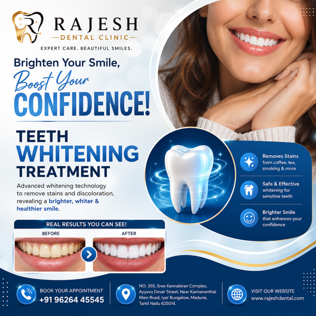 Best Teeth Whitening Clinic In Madurai