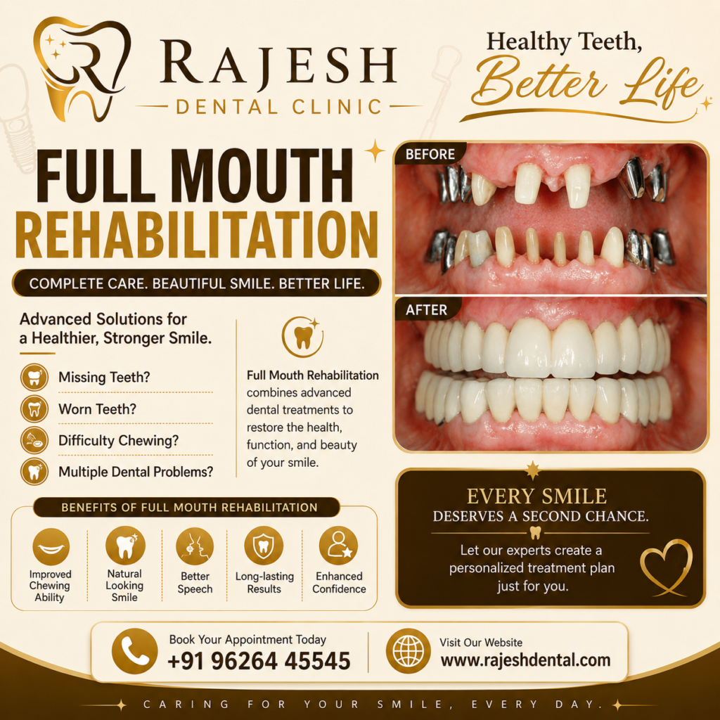 Full Mouth Rehabilitation In Madurai