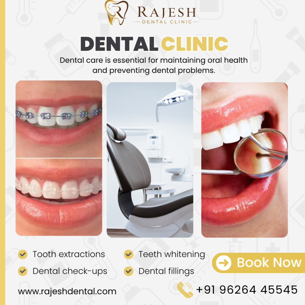 Tooth Extraction In Madurai
