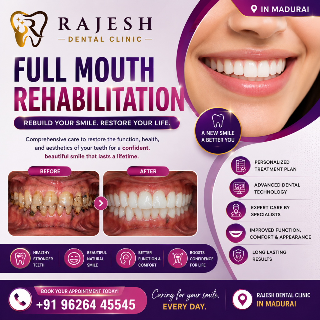 Full Mouth Rehabilitation Treatment In Madurai